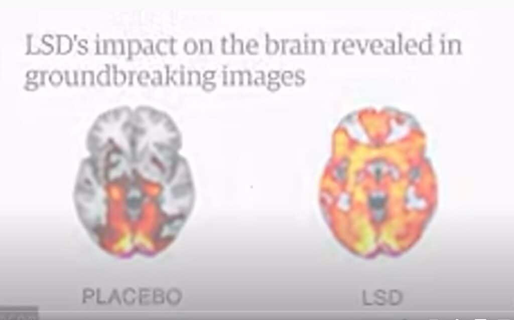 Your Brain on LSD